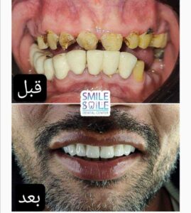 doctor-ayman-elshaikh-dentistry_20230413042727364