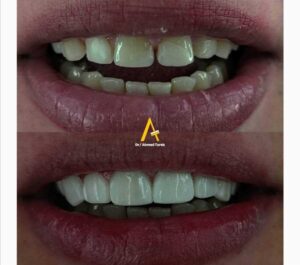 doctor-ayman-elshaikh-dentistry_20230413042735196